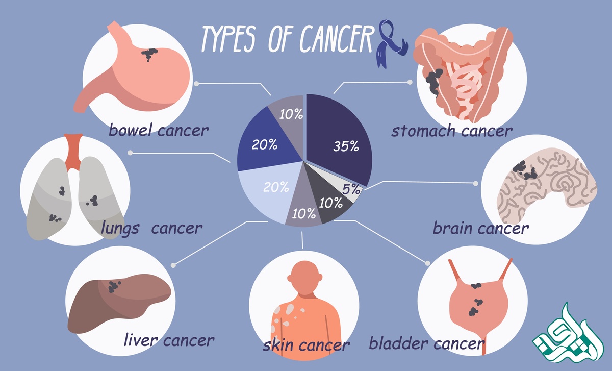 انواع سرطان