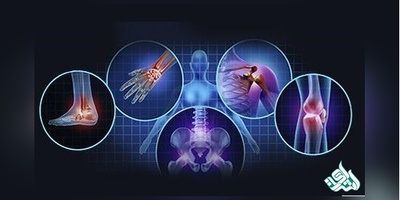 شرایط معافیت سربازی به علت بيمار ي هاي روماتولوژي و بافت همبند