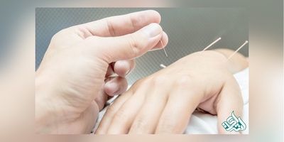 آزمون ارزشیابی رشته طب سوزنی تیرماه برگزار می شود