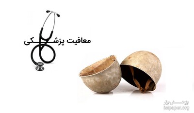 معافیت پزشکی حین تحصیل در سال 97
